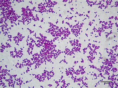 Chapter 1 Genus Staphylococci : Identification ,Diagnosis and Treatment