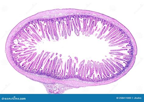 Small Intestine Duodenum And Vermiform Appendix Human Under The Microscope. Stock Image ...