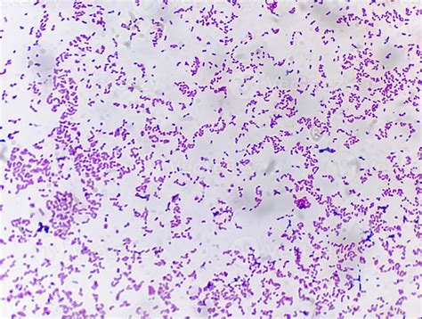 Escherichia coli bacterium, E.coli, gram-negative rod-shaped bacteria, part of intestinal normal ...