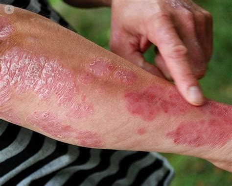 What causes a skin rash? | Top Doctors