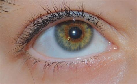 My sister just told me I have heterochromia but I always thought I just had hazel eyes. Idk what ...