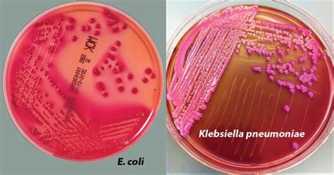 MacConkey Agar- Composition, Principle, Preparation, Results, Uses