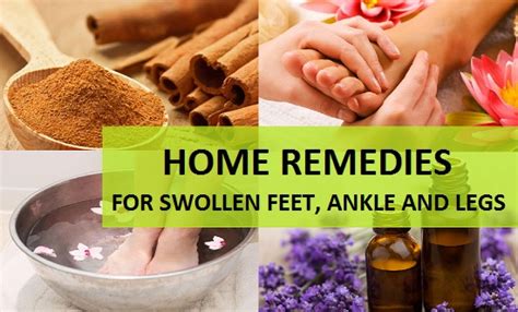 Home Remedies for Swollen Feet, Ankle and Legs