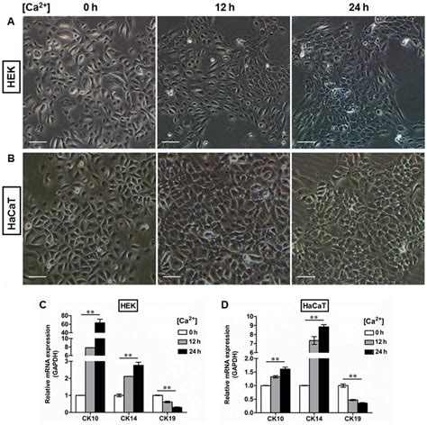 Generation of a differentiation model of epidermal cells in vitro ...