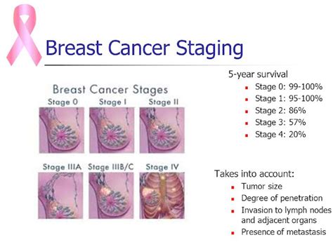 Breast Cancer Symptoms Review: Knowing about Stage 4 breast cancer symptoms