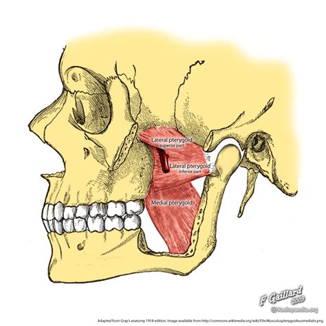 Infratemporal fossa:Lateral pterygoid | RANZCRPart1 Wiki | FANDOM powered by Wikia