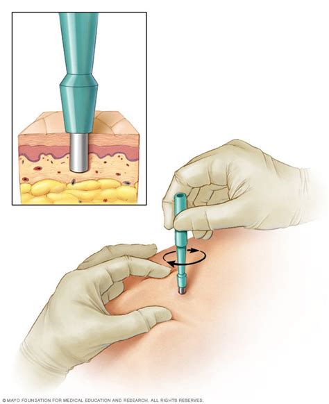 biopsy - DriverLayer Search Engine