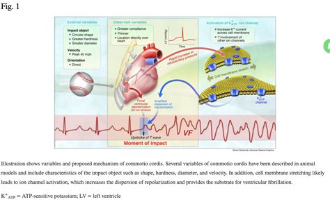 Commotio Cordis in Athletes - Sports Medicine Review