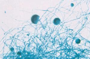 Rhizopus, Sporangia Slide | Ward's Science