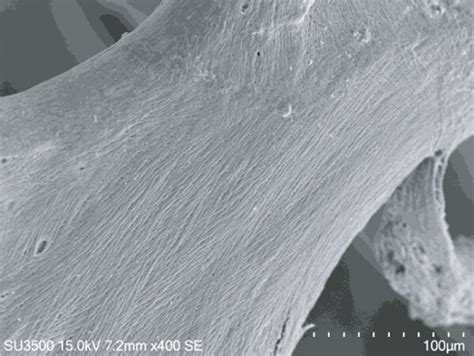 (a) SE mode, 400x. Incus bone surface from cadaver, normal surface. (b)... | Download Scientific ...