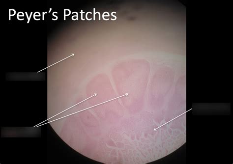 BSC216 Lab Exam 2 Peyer's Patches Histology Diagram | Quizlet