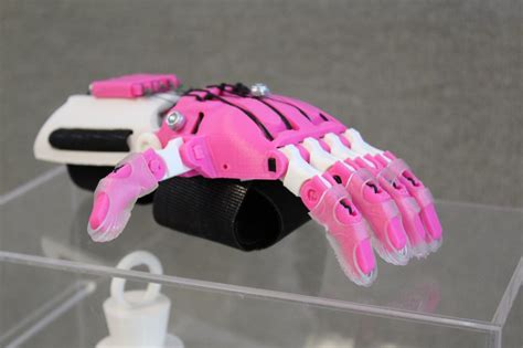 3D Printing Children's Prosthetic Hands at Your Library - The Digital Librarian