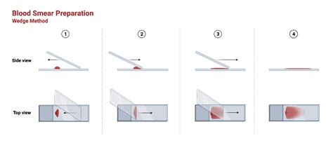 Blood Smear Preparation | BioRender Science Templates