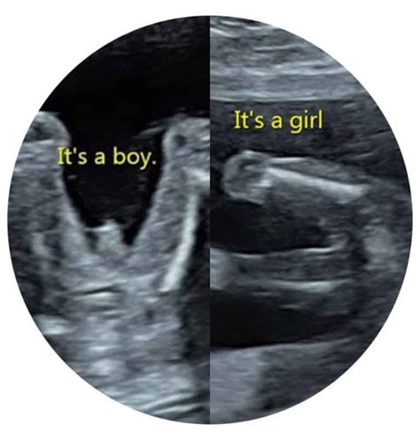 Gender Reveal Scan Gift Card - Window to the Womb