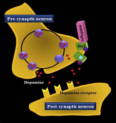 Dopamine Transporter SPECT Imaging in Parkinson Disease and Dementia - PET Clinics