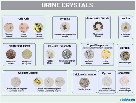 Urinary Crystals: Types, Causes, and Clinical Significance