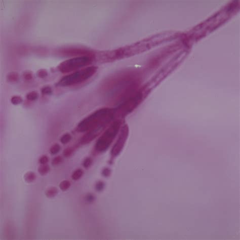 Penicillium Microscope