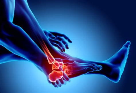 Early Signs of Arthritis in Feet