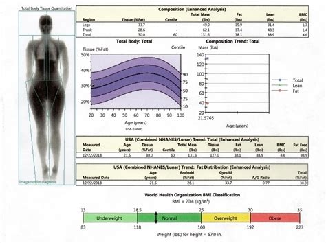 Dexa Scan | Bone Mineral Density Tool | ARC Recovery & Rehabilitation