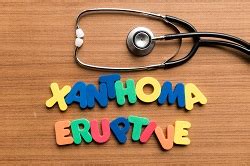 Xanthoma - Xanthelasma