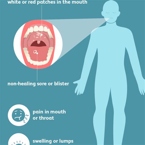 Jaw Cancer Lump - CancerWalls