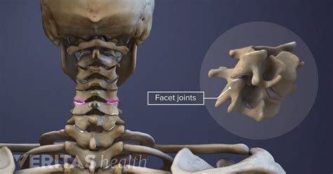 Surgery for Lumbar Facet Joint Disorders