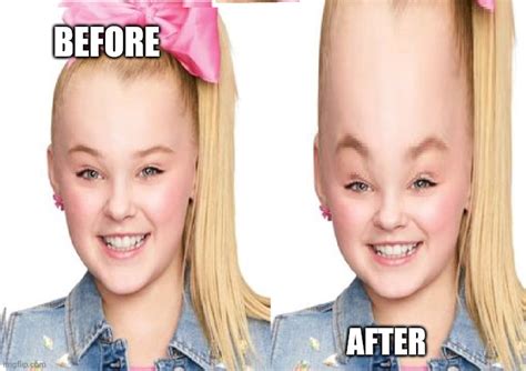 Big Forehead Meme