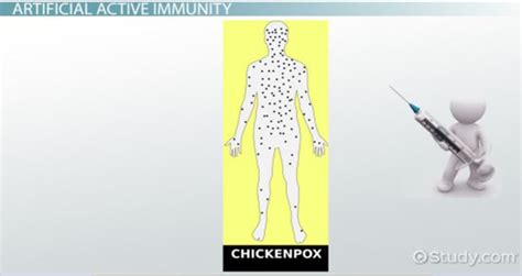 Active Immunity Types & Examples - Lesson | Study.com