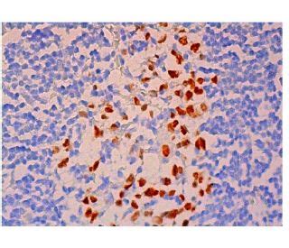 UHRF1 Antibody (H-8) - Immunohistochemistry - Image 313296