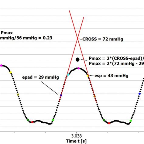 Calculation of right ventricular ejection fraction (RVEF) as... | Download Scientific Diagram