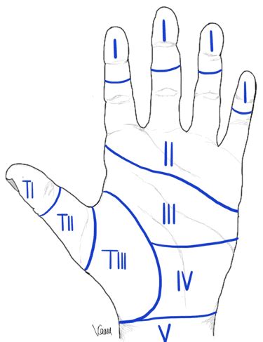 Flexor Tendon Zones Forearm