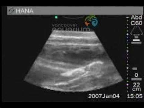 Pregnant Dolphin Ultrasound