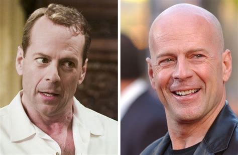 19 Bald Celebrities Before & After Embracing Baldness