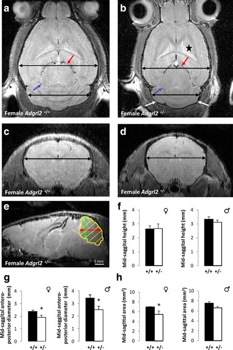 Main representative images and quantitative findings obtained from MRI... | Download Scientific ...