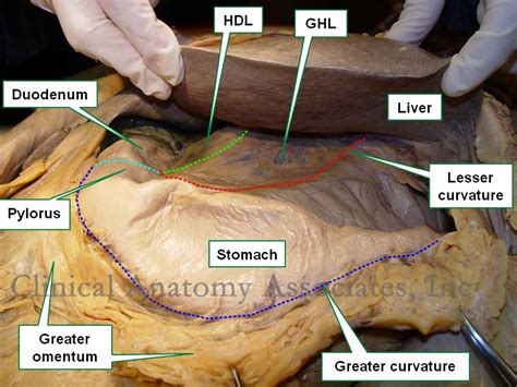 Hepatoduodenal Ligament Cadaver