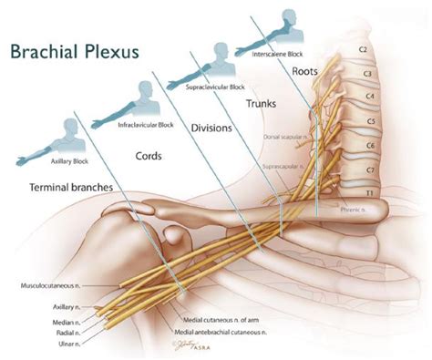 Supraclavicular Nerve Block