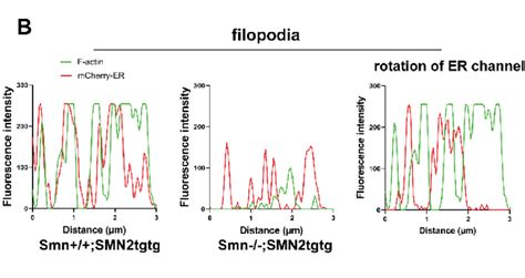 8.4 Overlap of ER with F-actin in growth cone filopodia is altered when... | Download Scientific ...