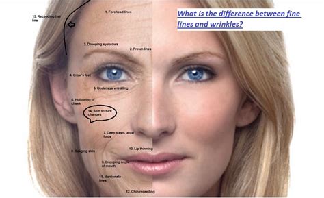 Wrinkles and Fine Lines: What’s the difference? Read More Here