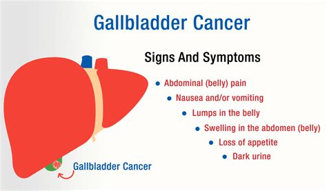 Gallbladder Cancer Symptoms - CancerWalls