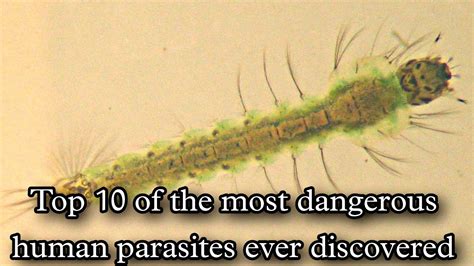 Top 10 Most Dangerous Parasites Ever Discovered | Top 10 | Information - YouTube