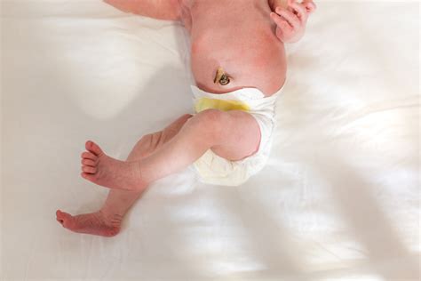 What Happens to Baby’s Umbilical Cord After Birth? - Pregnancy & Newborn Magazine