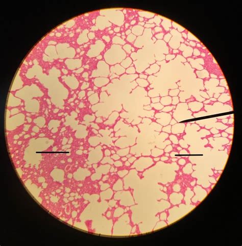 lung histology Diagram | Quizlet