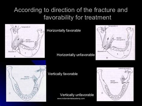 Mandibular Fracture Classification