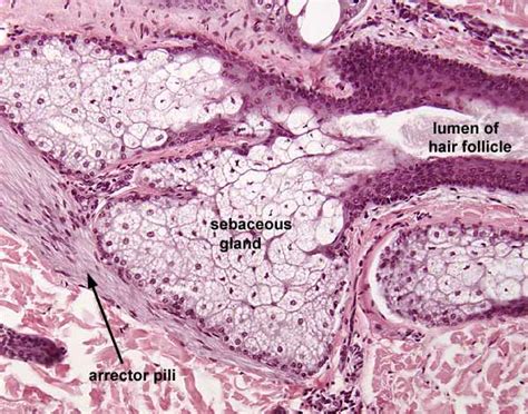 Sebaceous Glands Histology