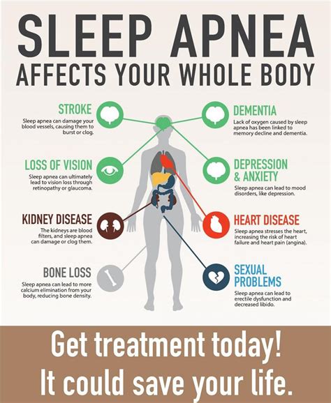 How Orthodontic Treatment Can Help Sleep Apnea Patients | RISUS ...