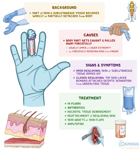 Degloving: What Is It, Causes, Clinical Presentation, and More | Osmosis