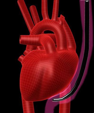 TEE Probe 101 - Innovatus Imaging