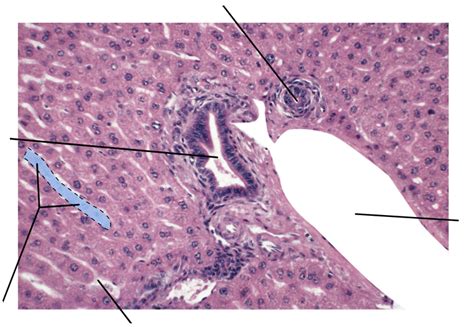 Liver, portal triad Diagram | Quizlet