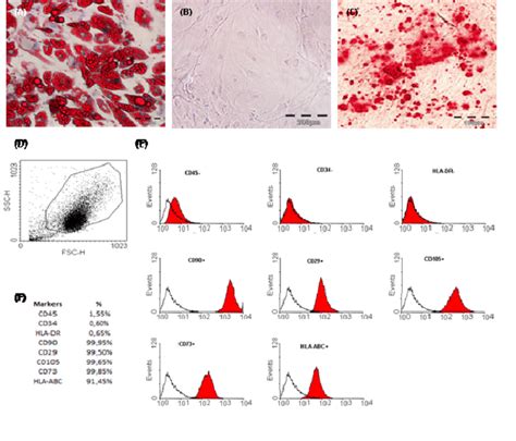 Characterization of Mesenchymal Stem Cells (MSC) derived from adipose ...