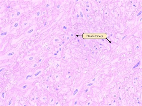 Elastic fibers contain the protein elastin, which co-polymerizes with ...